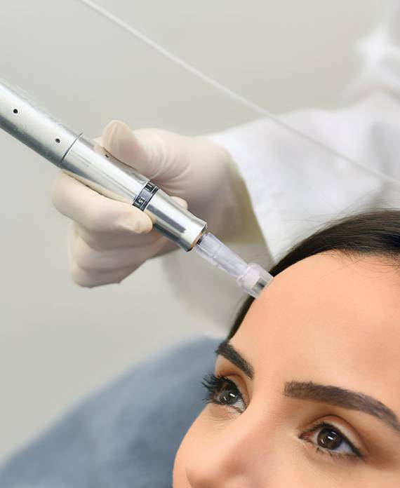 microneedling face treatment
