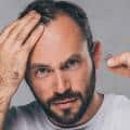 Why Is Hair Loss More Common Among Men?